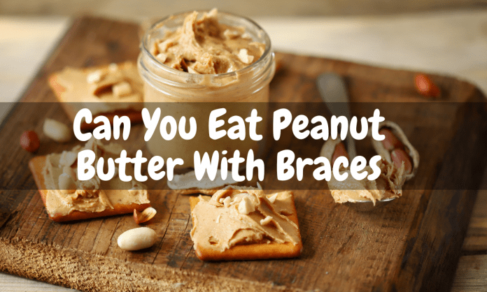 Can You Eat Peanut Butter With Braces